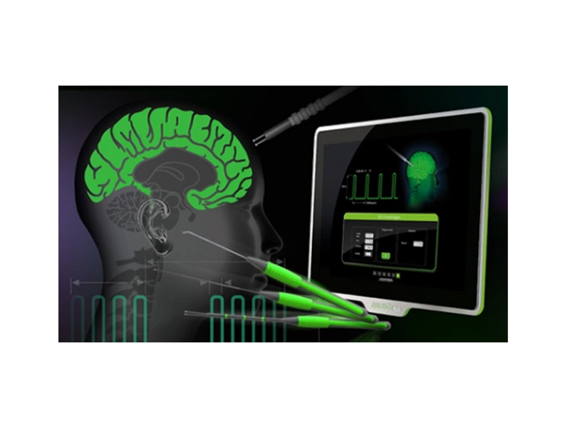 Intraoperative Neuro Monitoring System (IONM)