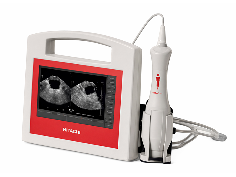 Bladder Scanner